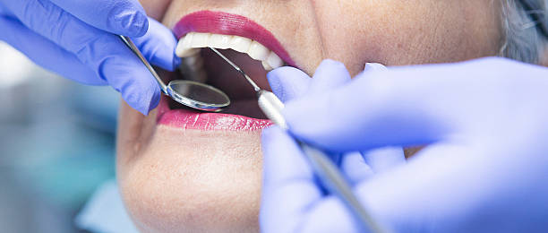 Best Knocked-Out Tooth Emergency  in Youngstown, OH